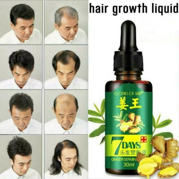 7 Day Ginger Germinal Oil Hair Growth Essence – 30ml | Fast Natural Hair Loss Treatment & Care