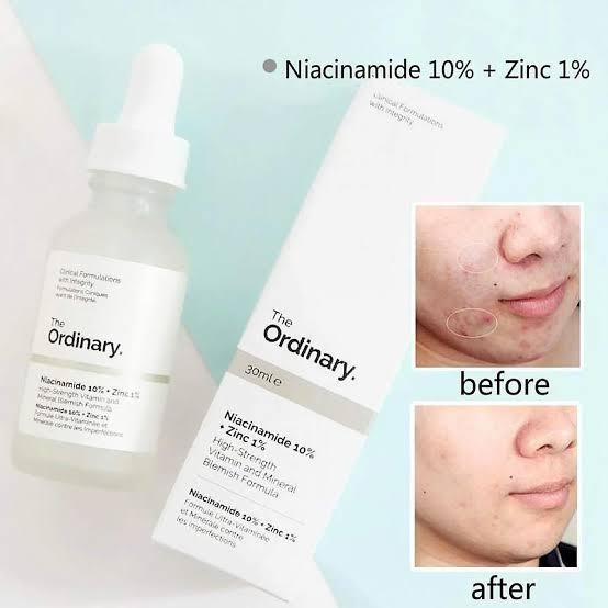 30ml Niacinamide Serum – Anti-Acne & Blemish Removal