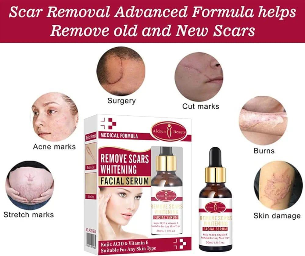 Scar Removal Facial Serum | Fades Dark Spots & Hydrates with Kojic Acid + Vitamin E