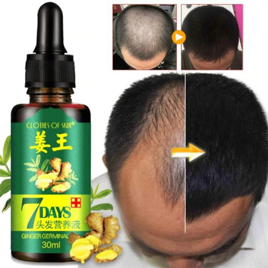 7 Day Ginger Germinal Oil Hair Growth Essence – 30ml | Fast Natural Hair Loss Treatment & Care