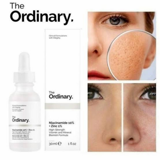 30ml Niacinamide Serum – Anti-Acne & Blemish Removal