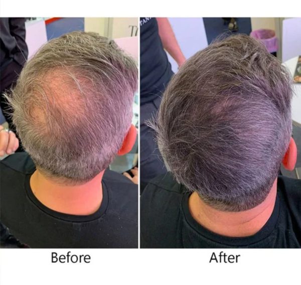 mages Hair Growth Serum 30ml – Strengthen & Lengthen | Reduce Shedding, Boost Volume