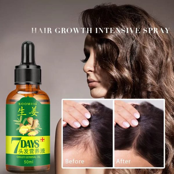 7 Day Ginger Germinal Oil Hair Growth Essence – 30ml | Fast Natural Hair Loss Treatment & Care