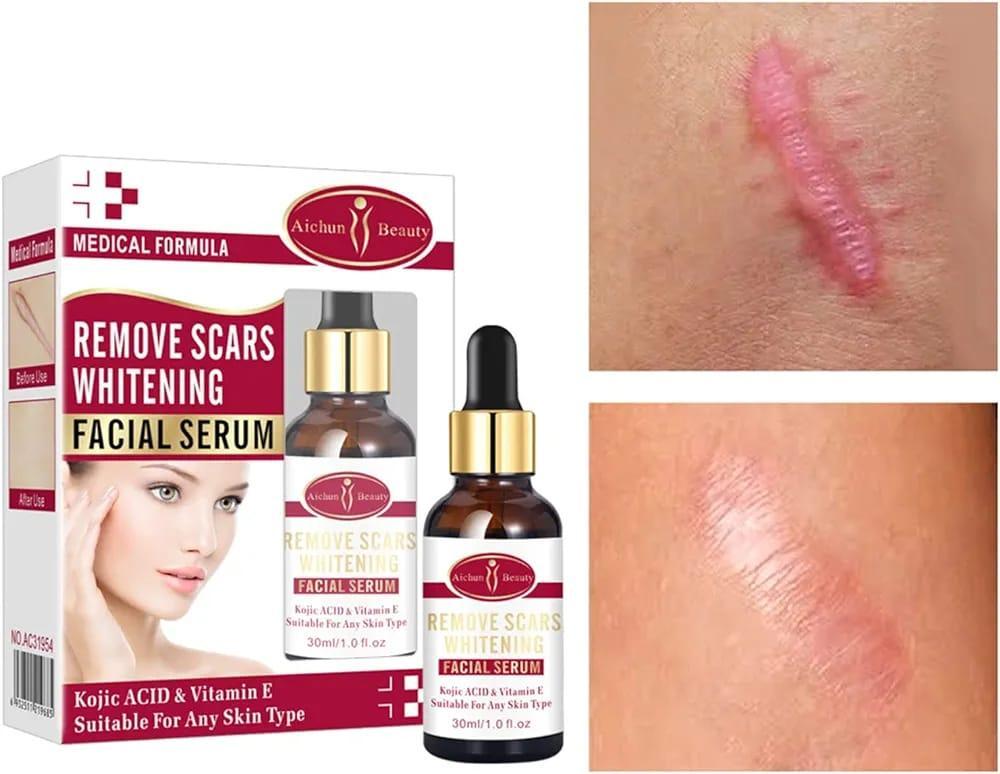 Scar Removal Facial Serum | Fades Dark Spots & Hydrates with Kojic Acid + Vitamin E