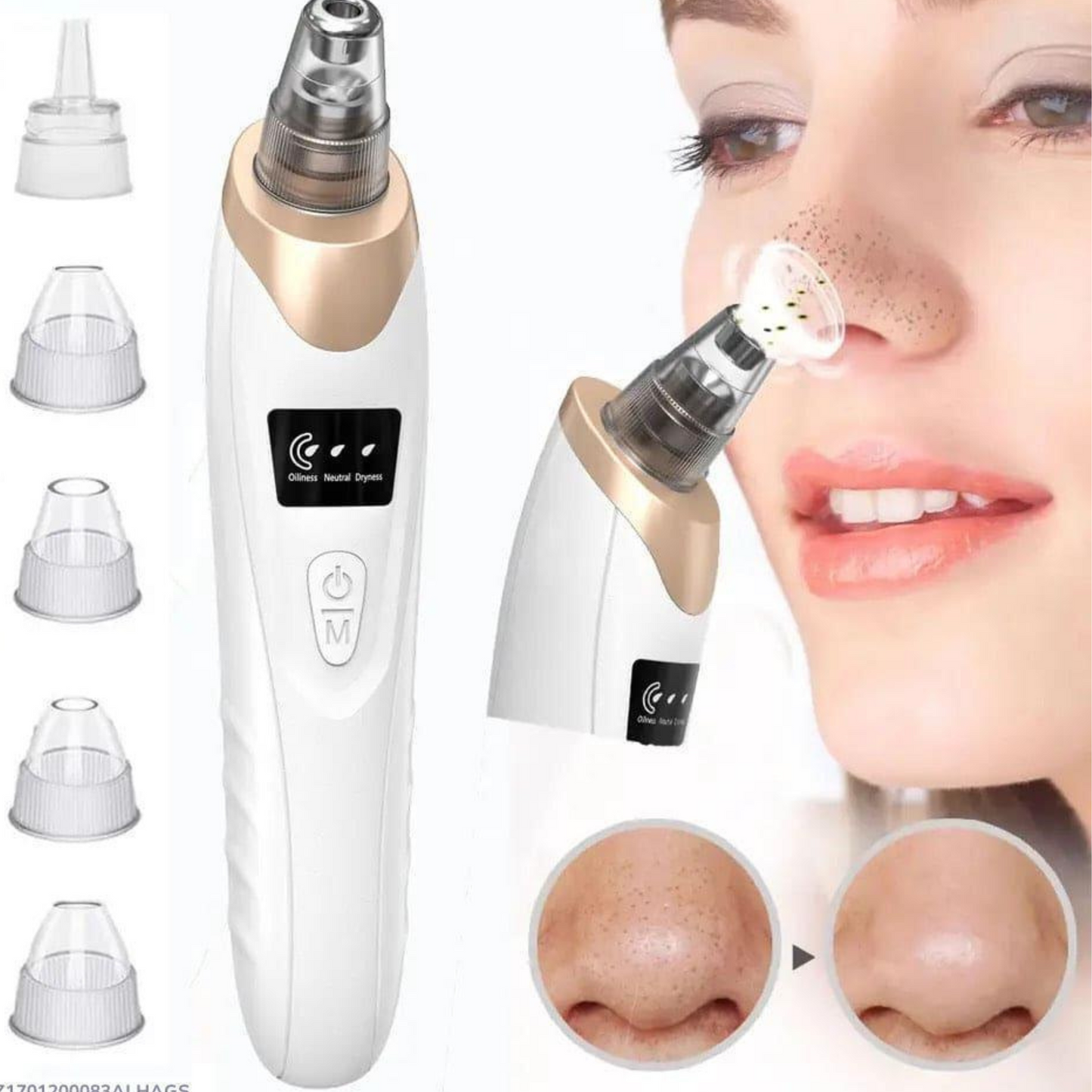 Acne Scar Removal & Blackhead Remover – Clear Skin Solution