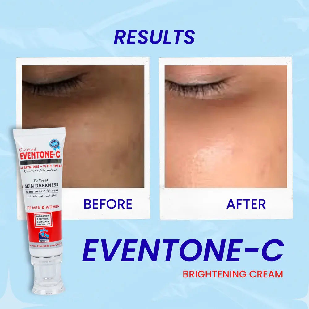 Eventone-C Cream with L-Glutathione & Vitamin C | Advanced Skin Brightening & Anti-Pigmentation Cream for Even, Radiant Skin