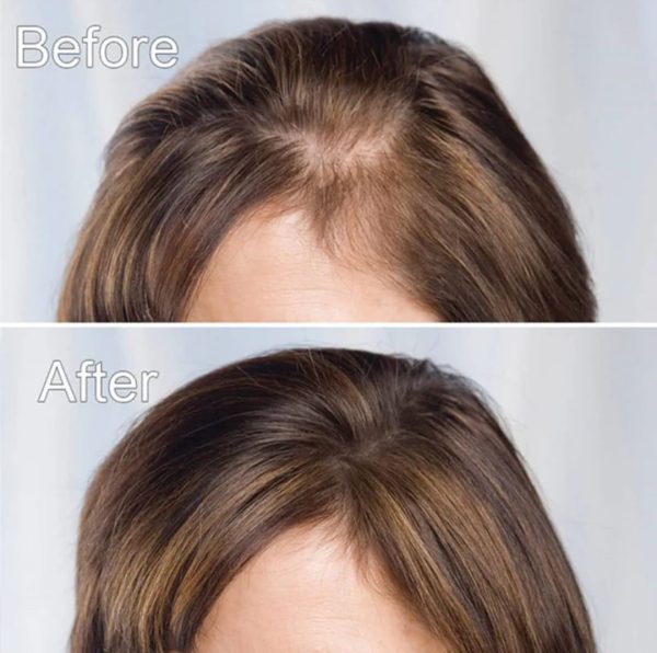 mages Hair Growth Serum 30ml – Strengthen & Lengthen | Reduce Shedding, Boost Volume